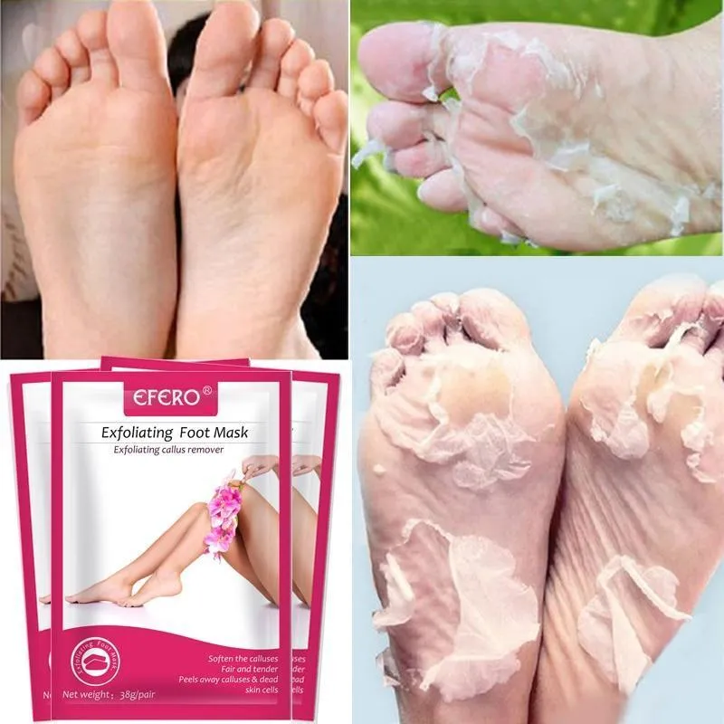 Baby Feet Exfoliation Foot Peel